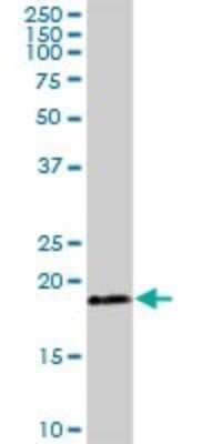 Western Blot: TIMM22 Antibody [H00029928-B01P]