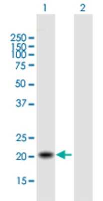 Western Blot: TIMM22 Antibody [H00029928-B01P]