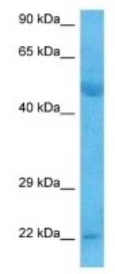 Western Blot: TIMM23 Antibody [NBP3-09960]