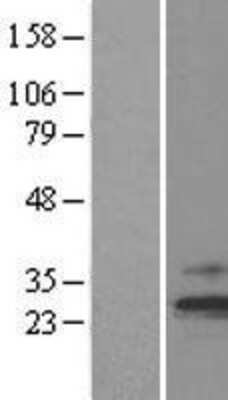 Western Blot: TIMM23 Overexpression Lysate [NBL1-16921]