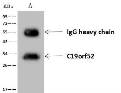 TIMM29 Antibody (NBP3-12622) by Novus, Part of Bio-Techne