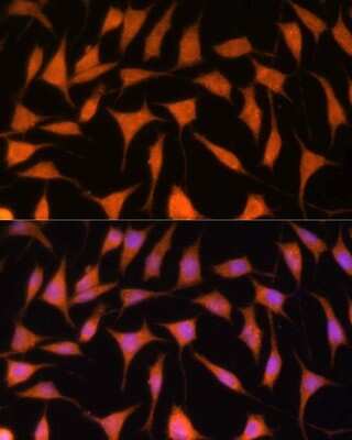 Immunocytochemistry/ Immunofluorescence: TIMM44 Antibody - Azide and BSA Free [NBP2-94065]