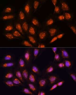 Immunocytochemistry/ Immunofluorescence: TIMM44 Antibody - Azide and BSA Free [NBP2-94065]