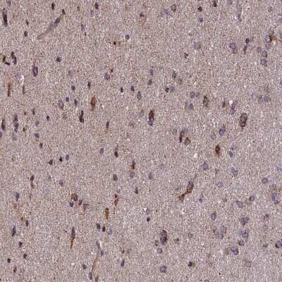 Immunohistochemistry-Paraffin: TIMM44 Antibody [NBP1-86941]