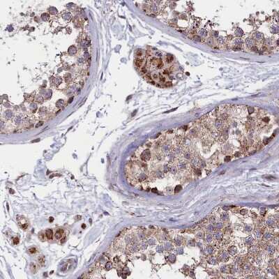 Immunohistochemistry-Paraffin: TIMM44 Antibody [NBP1-86941]