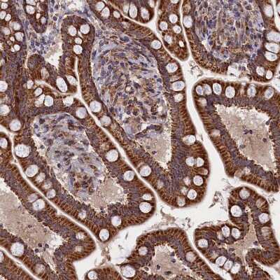 Immunohistochemistry-Paraffin: TIMM44 Antibody [NBP1-86941]