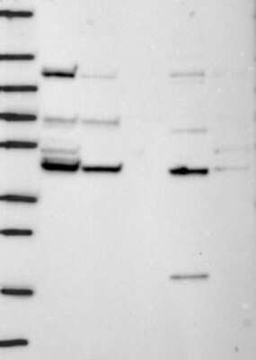 Western Blot: TIMM44 Antibody [NBP3-17319]