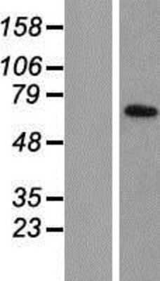 Western Blot: TIMM44 Overexpression Lysate [NBP2-07635]