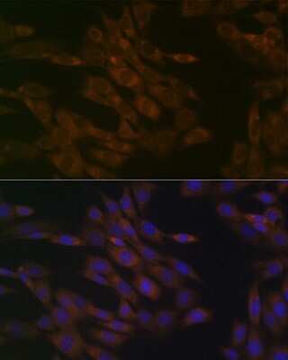 Immunocytochemistry/ Immunofluorescence: TIMM50 Antibody (0W6J4) [NBP3-15459]