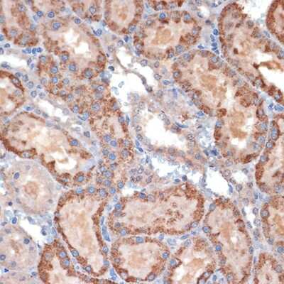 Immunohistochemistry-Paraffin: TIMM50 Antibody (0W6J4) [NBP3-15459]