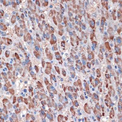 Immunohistochemistry-Paraffin: TIMM50 Antibody (0W6J4) [NBP3-15459]