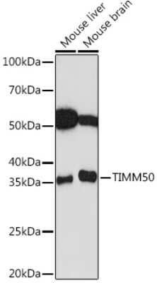 Western Blot: TIMM50 Antibody (0W6J4) [NBP3-15459]