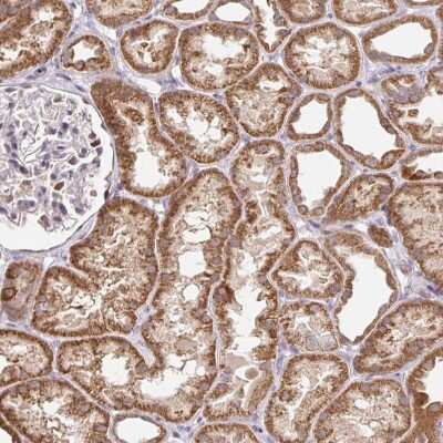 Immunohistochemistry-Paraffin: TIMM50 Antibody [NBP2-38791]