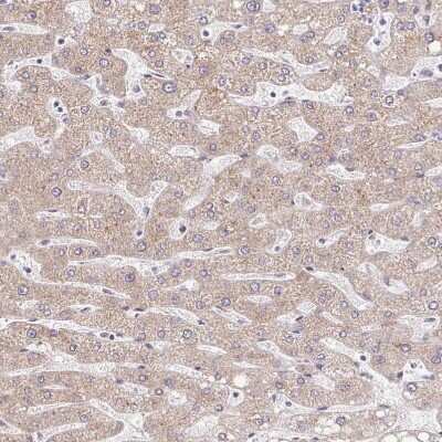 Immunohistochemistry-Paraffin: TIMM50 Antibody [NBP2-38791]