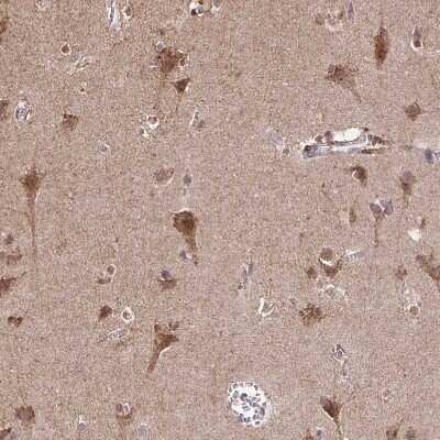 Immunohistochemistry-Paraffin: TIMM50 Antibody [NBP2-38791]