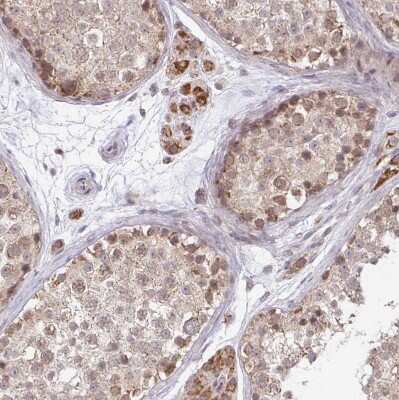 Immunohistochemistry-Paraffin: TIMM50 Antibody [NBP2-38791]