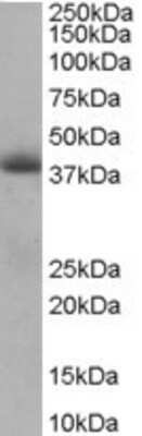 Western Blot: TIMM50 Antibody [NB100-1462]