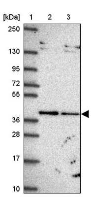 Western Blot: TIMM50 Antibody [NBP2-38791]