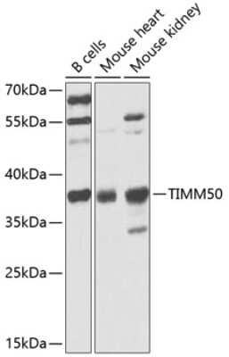 Western Blot: TIMM50 AntibodyBSA Free [NBP2-94349]