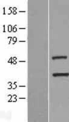 Western Blot: TIMM50 Overexpression Lysate [NBP2-08987]