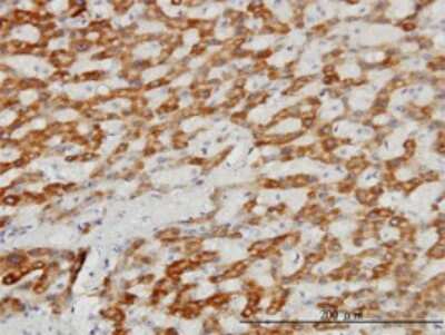 Immunohistochemistry-Paraffin: TIMM8A Antibody (2F11) [H00001678-M01]