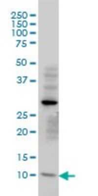 Western Blot: TIMM8A Antibody (2F11) [H00001678-M01]