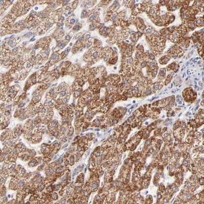 Immunohistochemistry-Paraffin: TIMM8A Antibody [NBP1-84288]