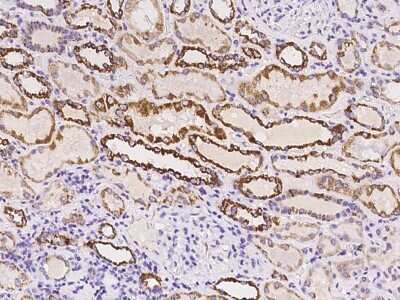 Immunohistochemistry-Paraffin: TIMM8A Antibody [NBP2-98033]