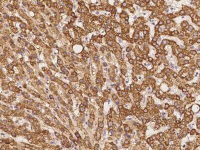 Immunohistochemistry-Paraffin: TIMM8A Antibody [NBP2-98033]