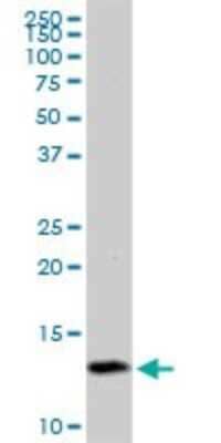 Western Blot: TIMM8A Antibody [H00001678-B01P]