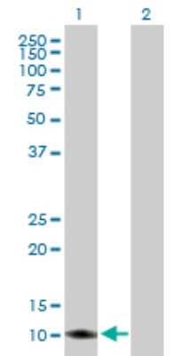 Western Blot: TIMM8A Antibody [H00001678-B01P]