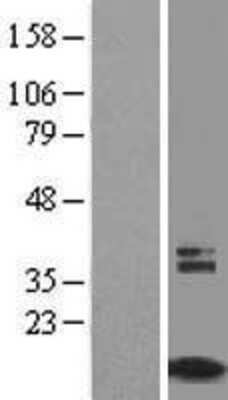 Western Blot: TIMM8A Overexpression Lysate [NBL1-16922]