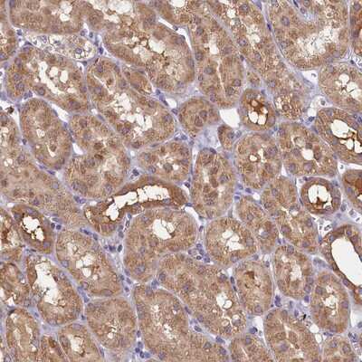 Immunohistochemistry-Paraffin: TIMM8B Antibody [NBP1-84287]