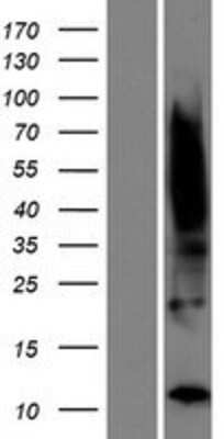 Western Blot: TIMM8B Overexpression Lysate [NBP2-10222]