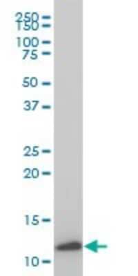 Western Blot: TIMM9 Antibody (1D6) [H00026520-M01]