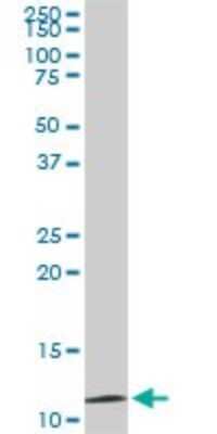 Western Blot: TIMM9 Antibody (1D6) [H00026520-M01]