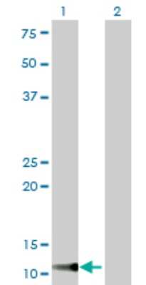 Western Blot: TIMM9 Antibody (1D6) [H00026520-M01]