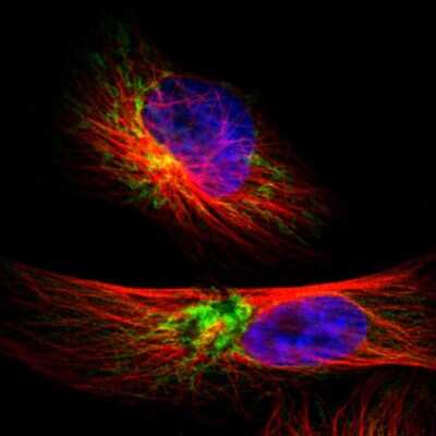 Immunocytochemistry/ Immunofluorescence: TIMM9 Antibody [NBP1-80679]