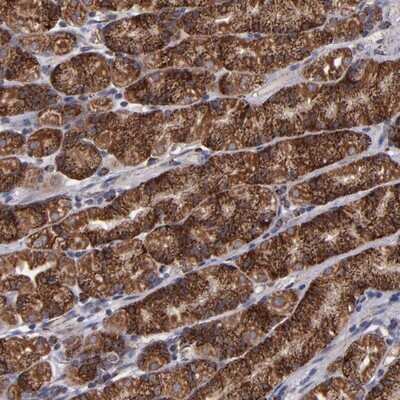 Immunohistochemistry-Paraffin: TIMM9 Antibody [NBP1-80679]
