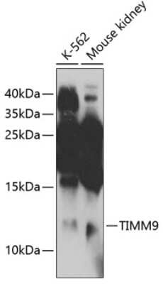 Western Blot: TIMM9 AntibodyBSA Free [NBP3-04808]