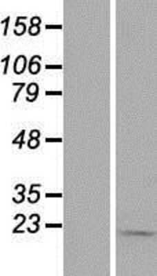 Western Blot: TIMM9 Overexpression Lysate [NBP2-07442]