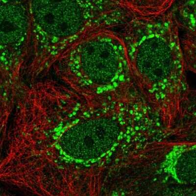 Immunocytochemistry/ Immunofluorescence: TIMMDC1 Antibody [NBP2-13433]