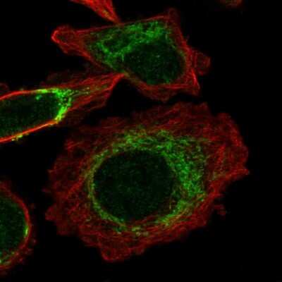 Immunocytochemistry/ Immunofluorescence: TIMMDC1 Antibody [NBP2-38773]