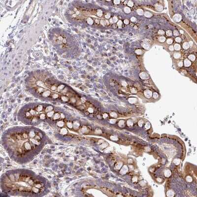 Immunohistochemistry-Paraffin: TIMMDC1 Antibody [NBP2-13433]