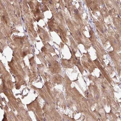 Immunohistochemistry-Paraffin: TIMMDC1 Antibody [NBP2-13433]
