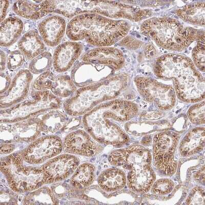 Immunohistochemistry-Paraffin: TIMMDC1 Antibody [NBP2-13433]