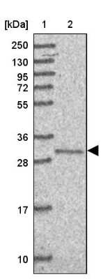 Western Blot: TIMMDC1 Antibody [NBP2-13433]