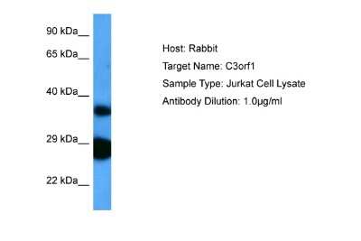 Western Blot: TIMMDC1 Antibody [NBP2-85919]