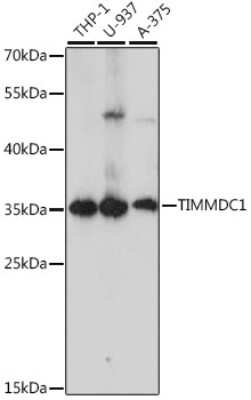 Western Blot: TIMMDC1 AntibodyAzide and BSA Free [NBP2-94234]