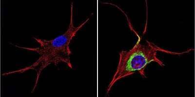 Immunocytochemistry/ Immunofluorescence: TIMP-1 Antibody (F31 P2 A5) [NB100-74551]